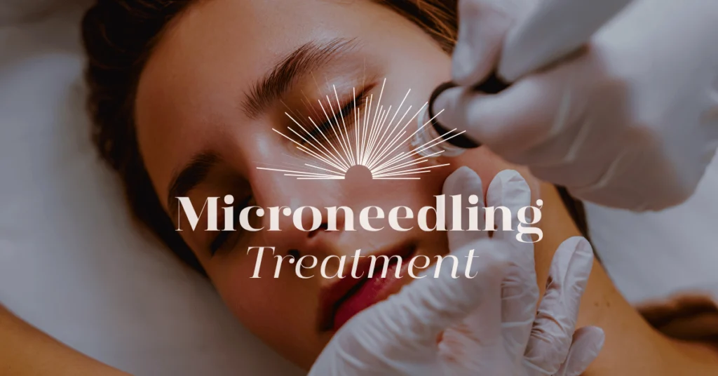 Microneedling Treatments for Cleansing Skin in Kilcullen in MC Beauty House Marta Czarnecka